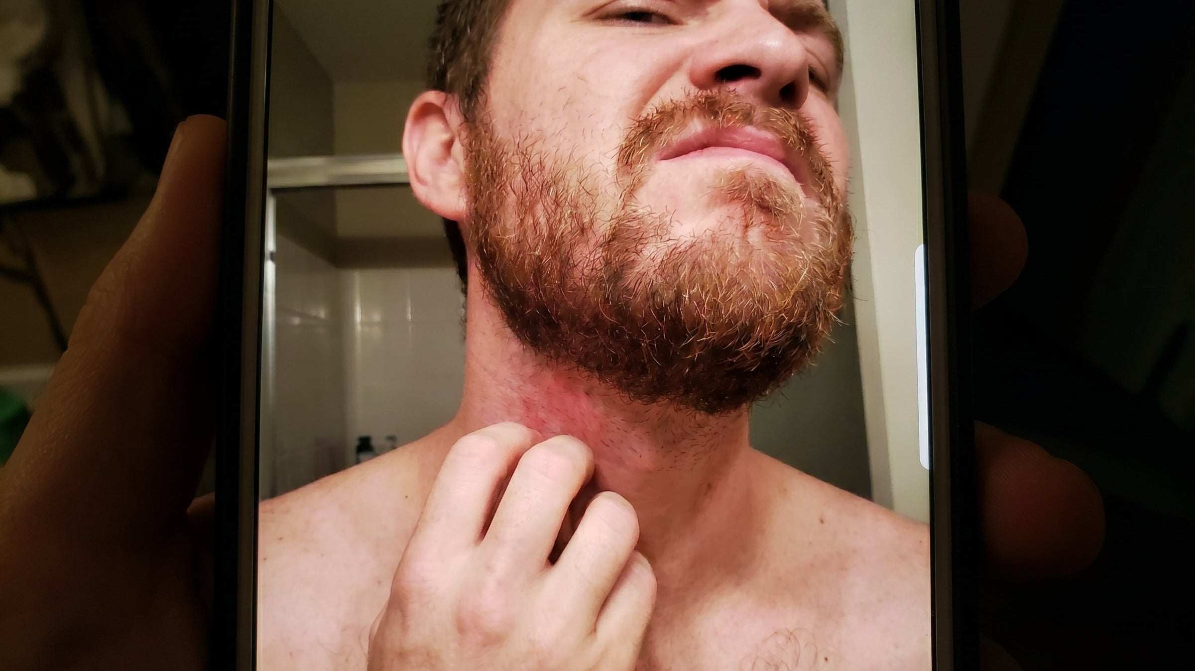 MEN STUFF Beard Itch