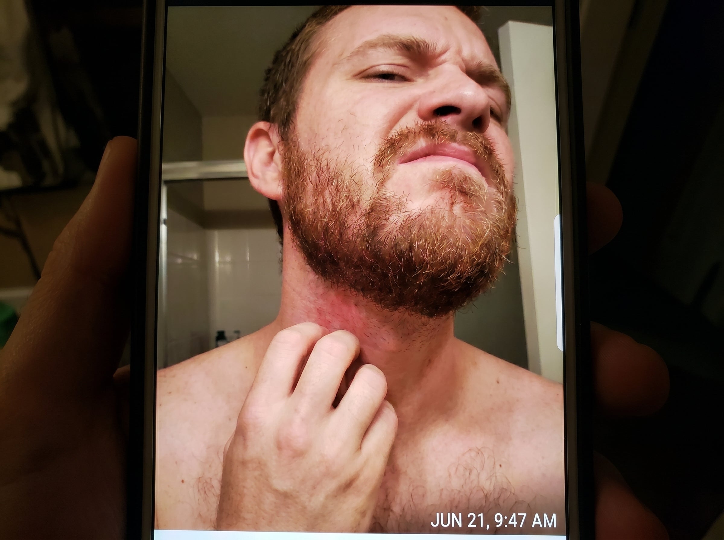 MEN STUFF Beard Itch